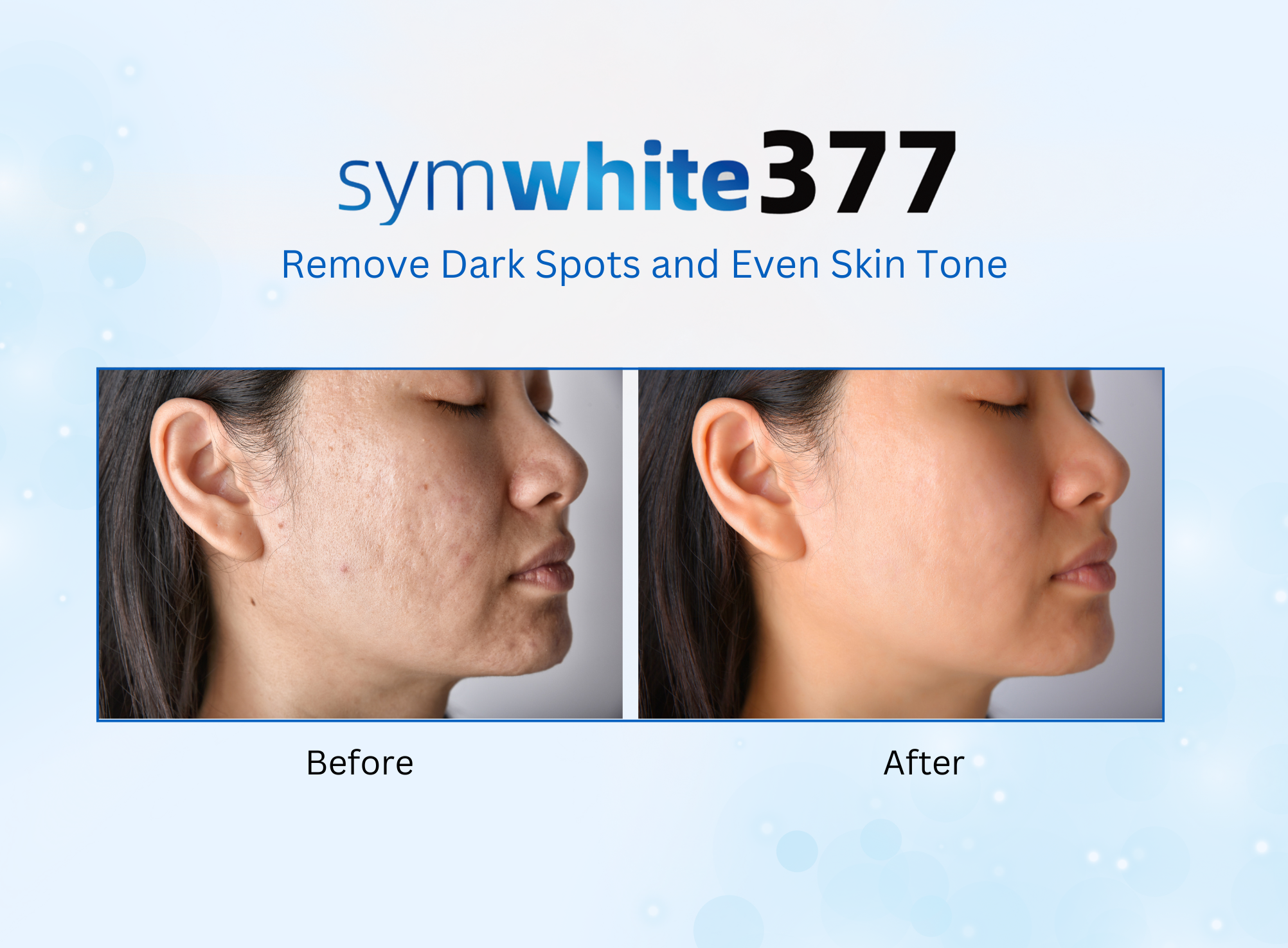 Envi Symwhite 377 Full Set (4pcs) - Anti Dark Spot and Brightening Skincare